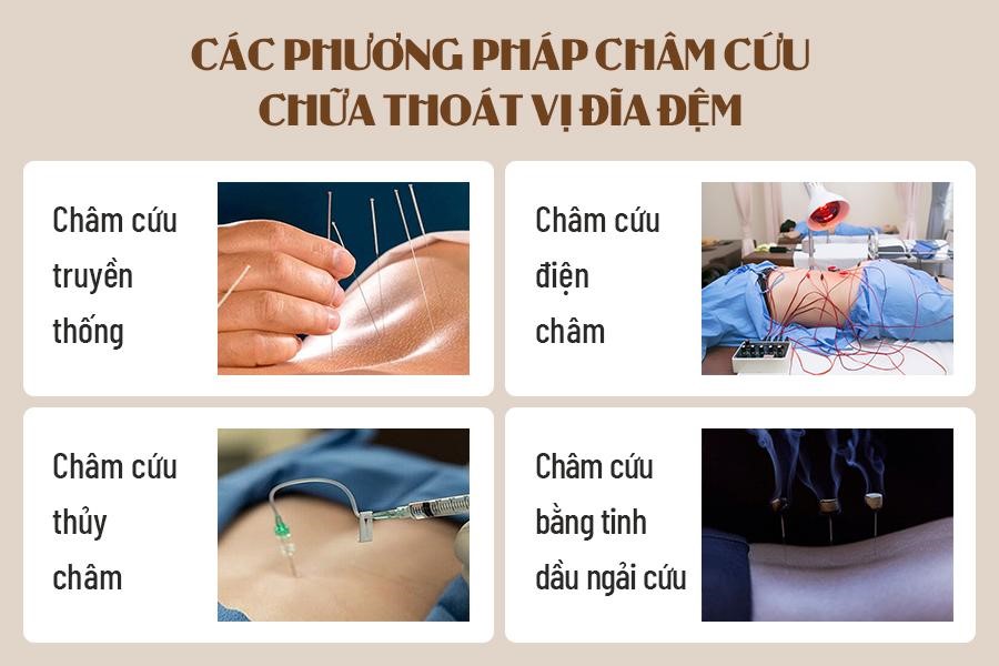 Điều Trị Thoát Vị Đĩa Đệm Tại Nhà